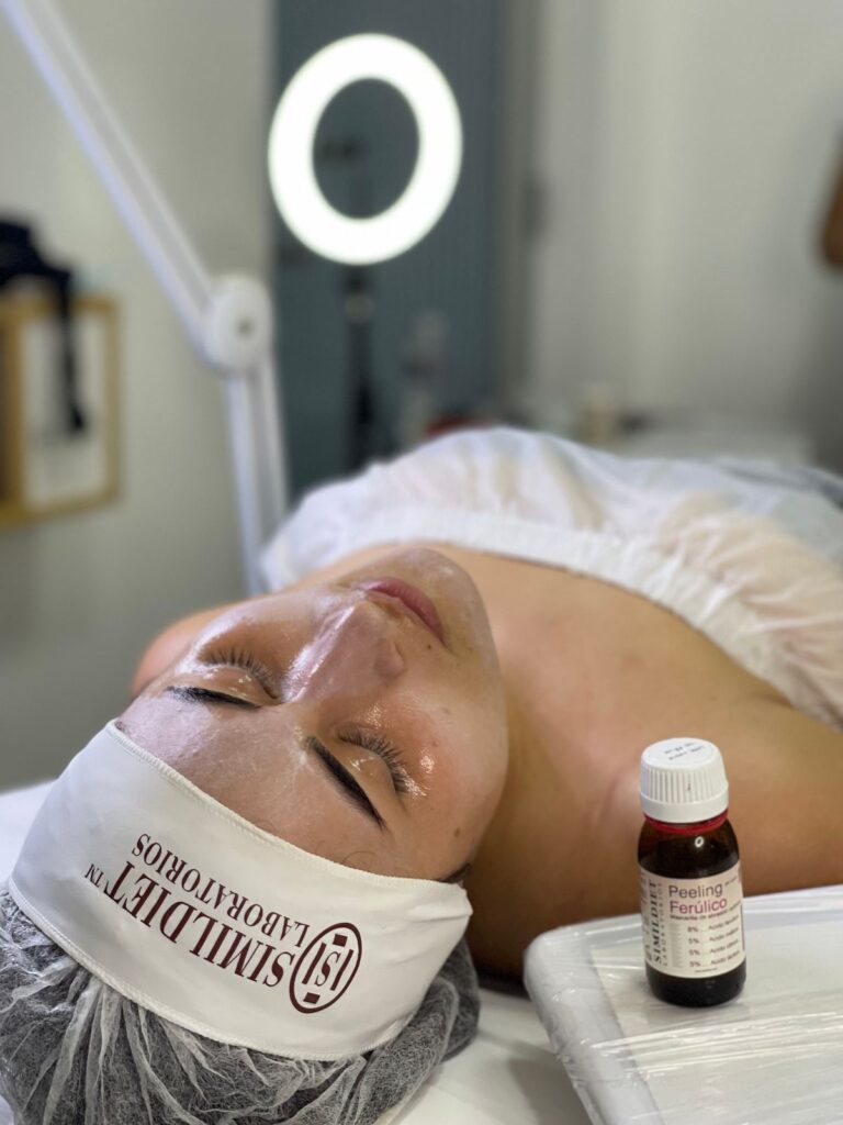 Acne Lift peel solution on a client's face during a facial peel